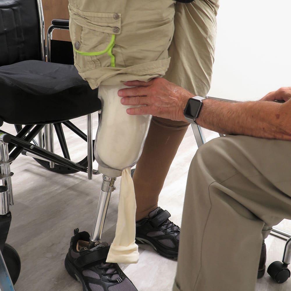 amputations and crush injuries attorney houston
