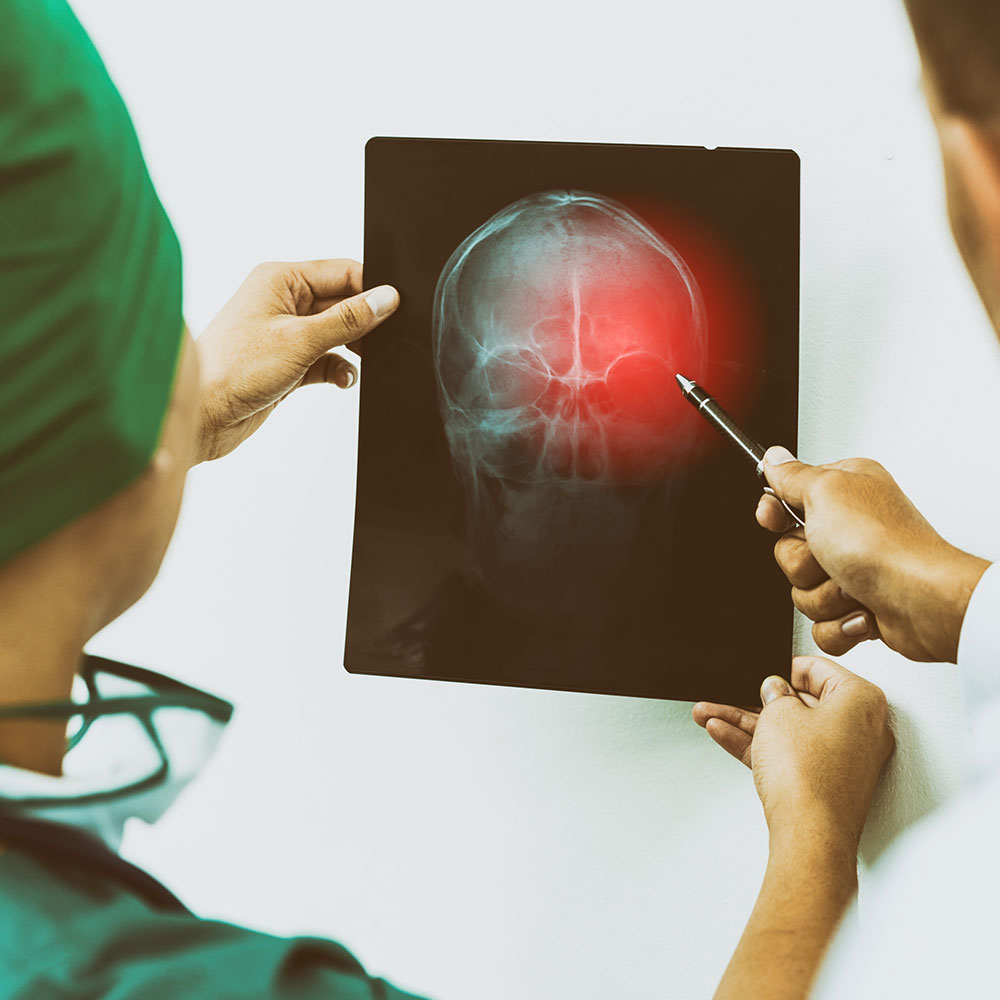 houston brain injury attorney