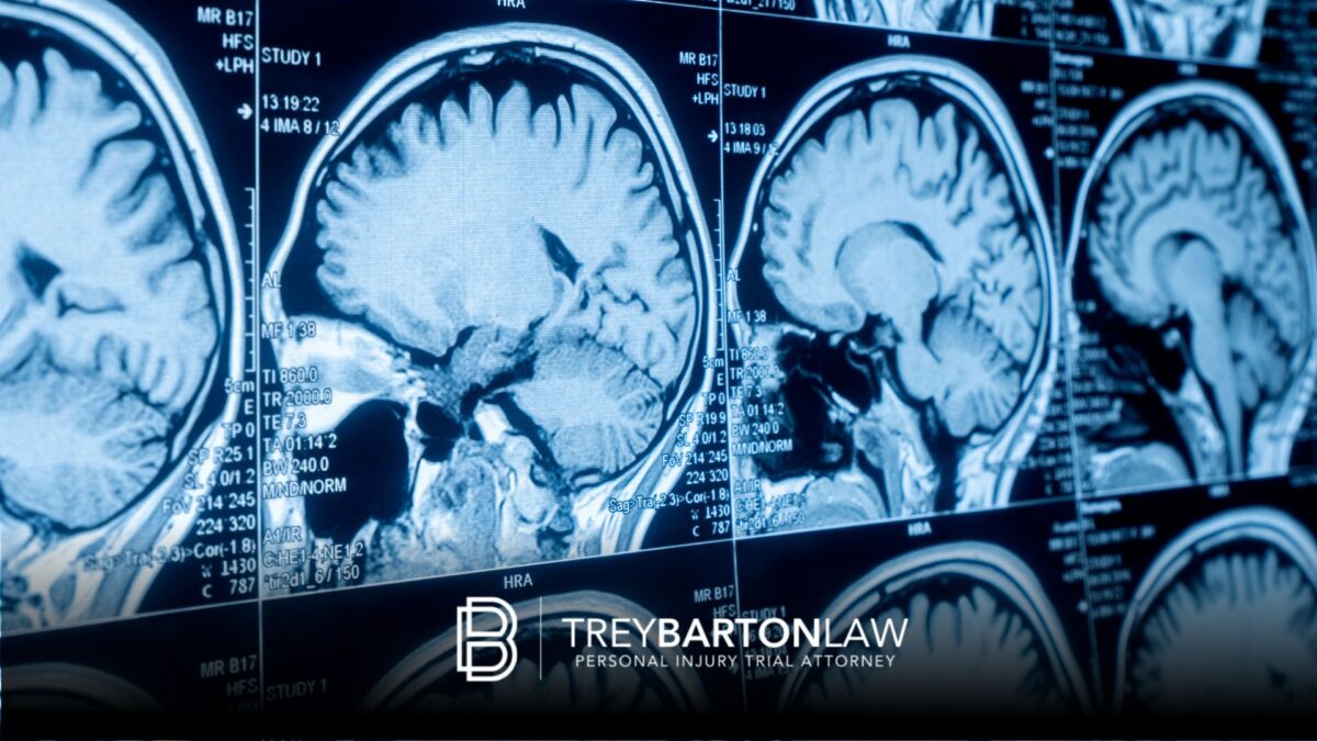 Houston brain injury attorneys