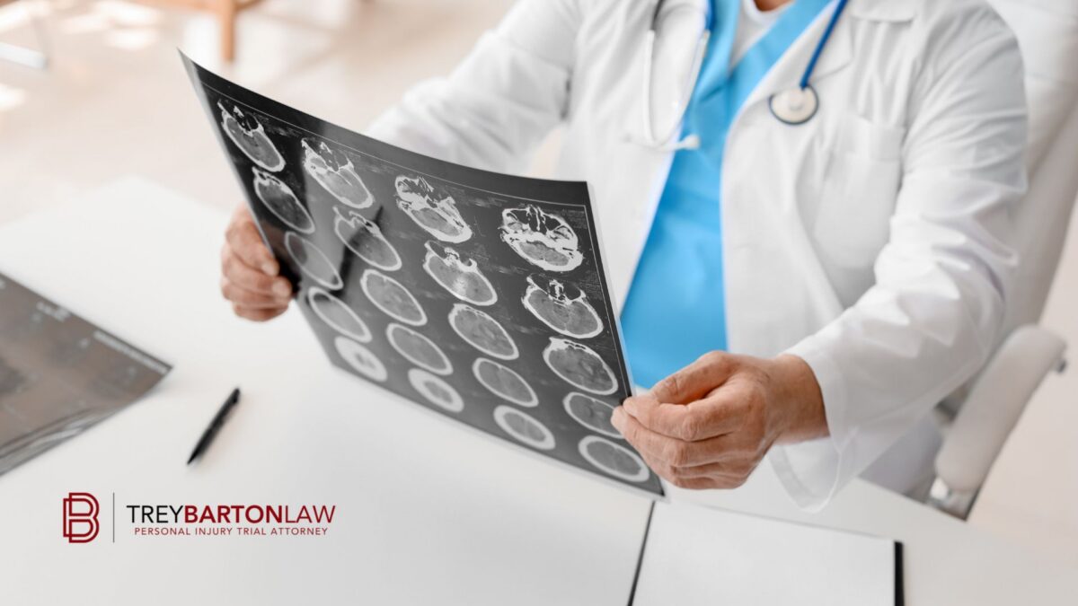 Houston brain injury lawyer